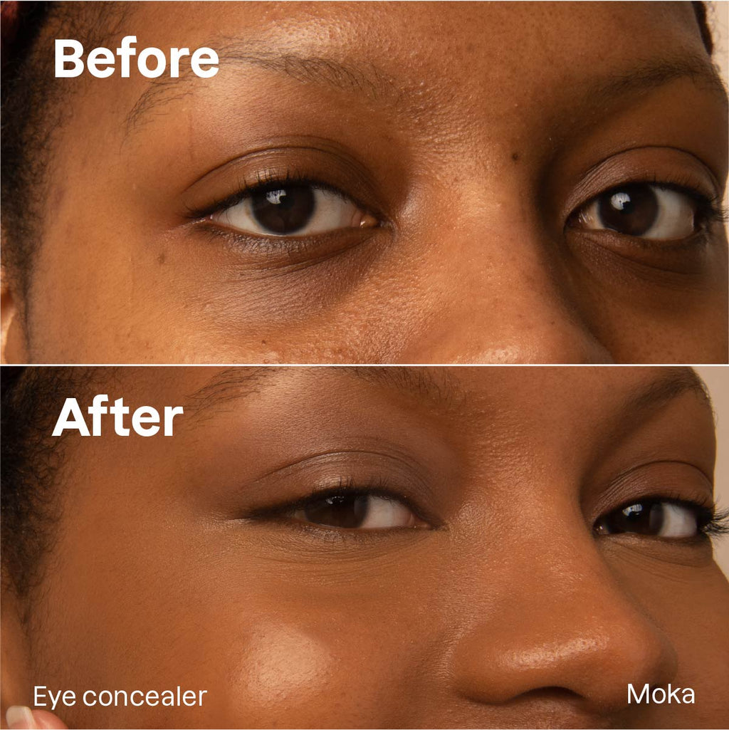 Concealer