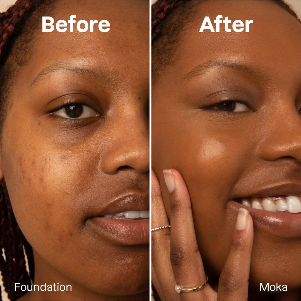 Foundation